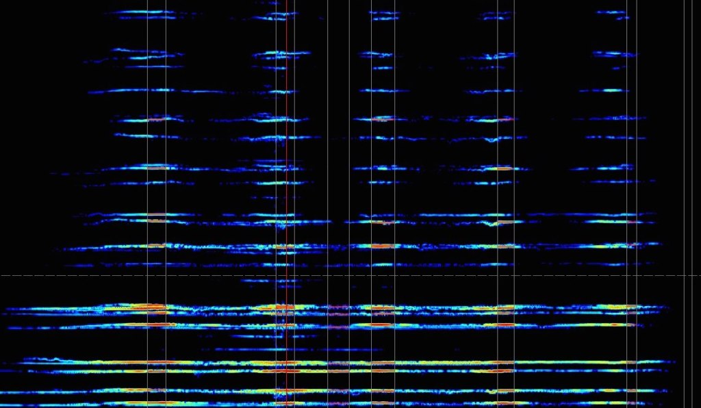 Sonogram large